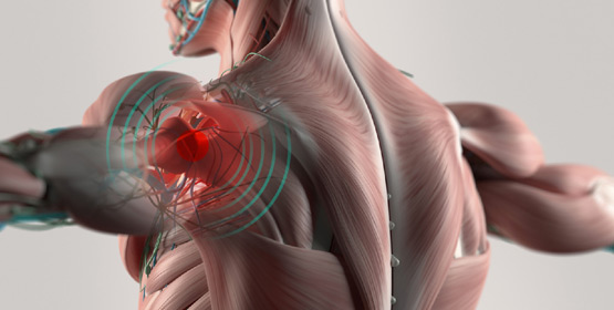 TRAUMATOLOGIA OSTEOARTICOLARE TRAUMATOLOGIA OSTEOARTICOLARE